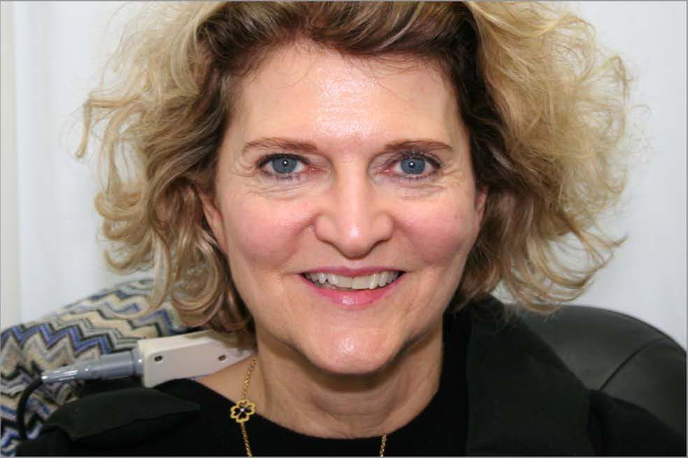 Bioflex Laser Therapy Cape Heath Centre for Bells Palsy