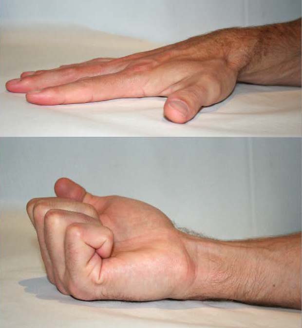 Bioflex Laser Therapy Cape Heath Centre for fractures